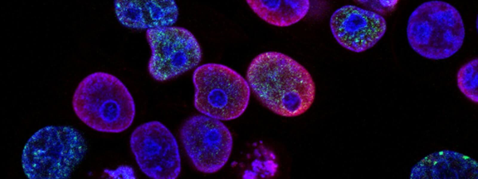 乳酸菌和醋酸菌共培養：提升Nisin產量